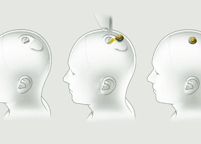 马斯克将宣布研发；d其脑计算机公司10月31日的进展和演示。