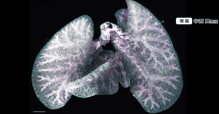 东京大学去除老化细胞的新研究成功，将大大改善老年人的健康时期。