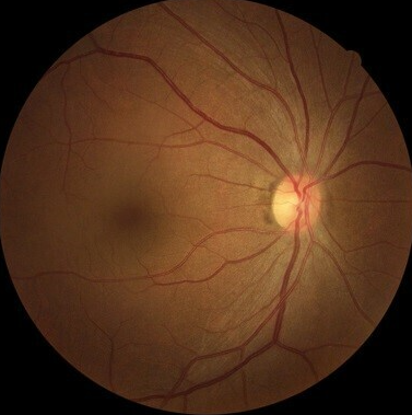 日本研究组织免费公开新的AI研究，通过视网膜照片来识别年龄血糖